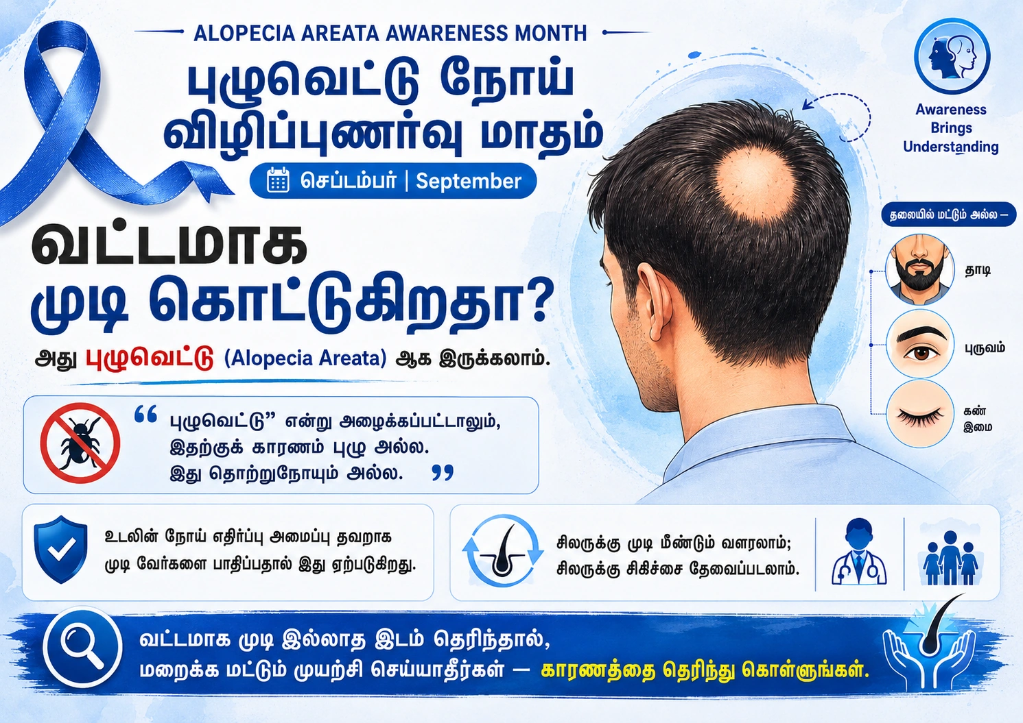 Poster 1: Alopecia areata: round or patchy hair loss