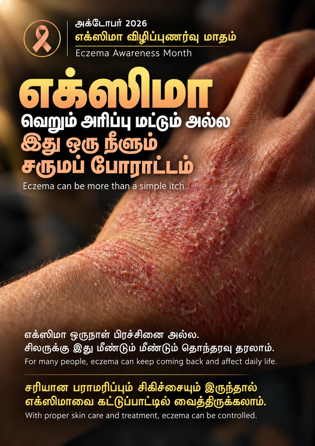 Eczema Awareness Month 2026, poster 1: Eczema is more than an itch.